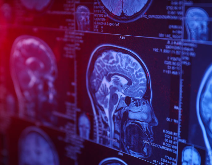 mri brain scan - mind reading technology - privacywe